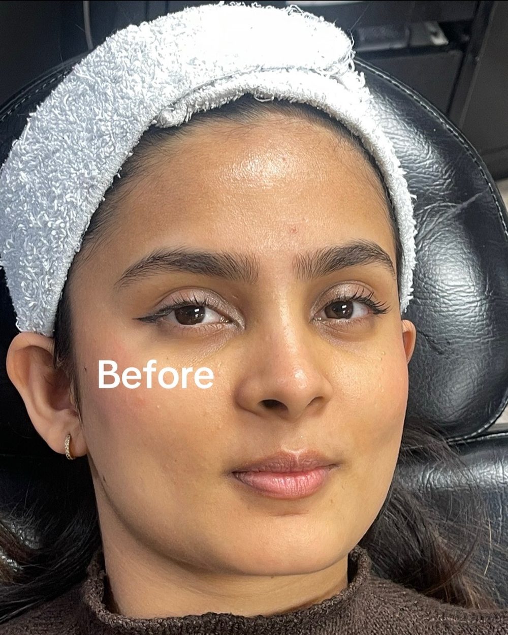 Client's skin before a facial